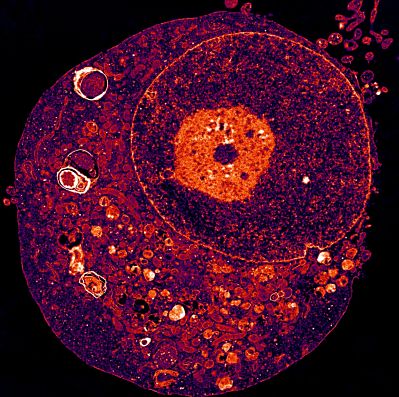 Cerveau : les chercheurs décèlent le 